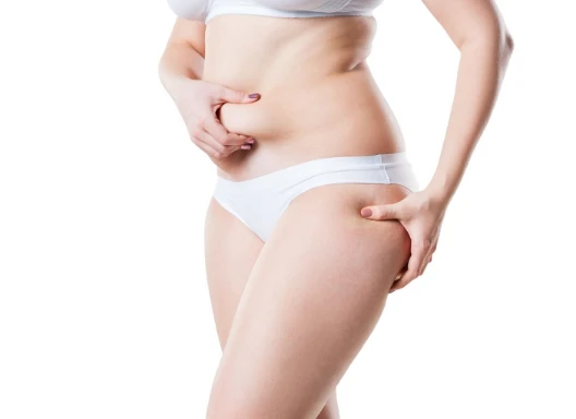 liposuccion dr martin diaz