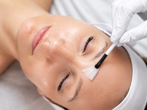 Peeling Facial